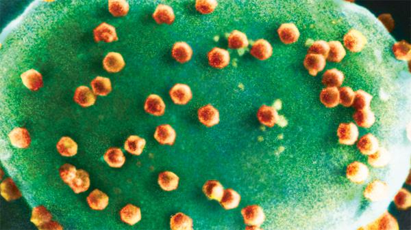 Yellow chlorovirus particles infecting microscopic green algae